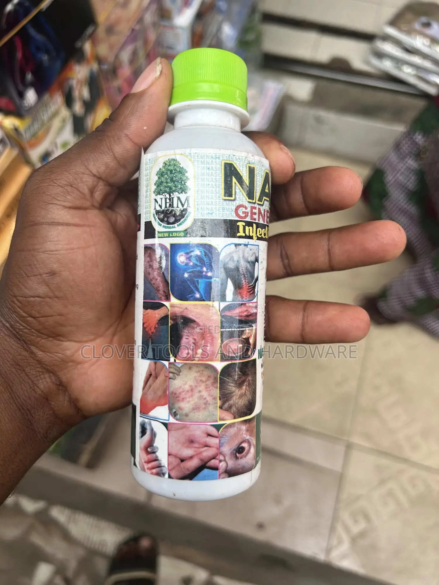 Amya General Infection and Gonorrhea Infection Cure