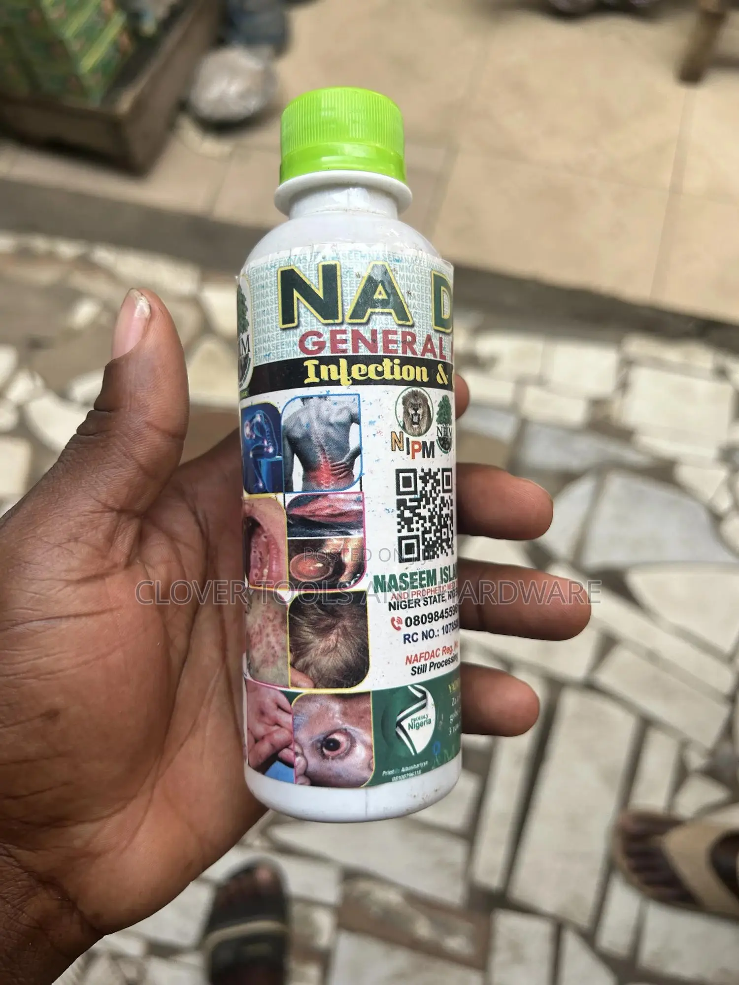 Amya General Infection and Gonorrhea Infection Cure