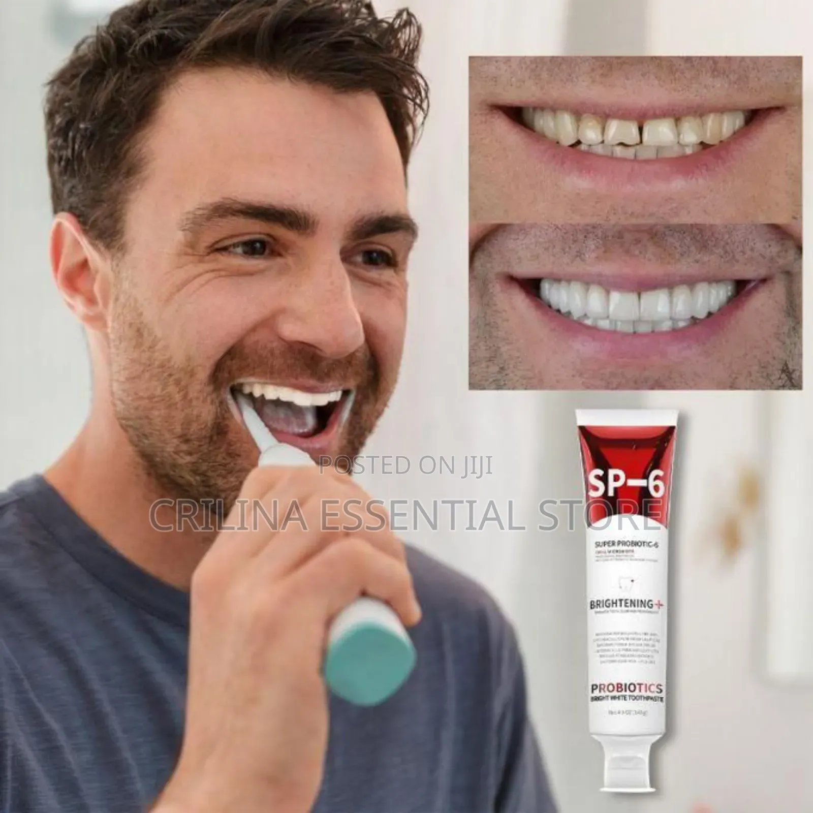 Sp-6 Probiotics Toothpaste for Healthy Teeth