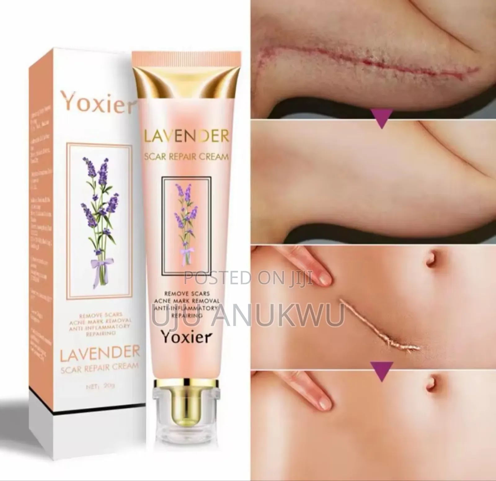 Yoxier Lavender Scar Repair Cream