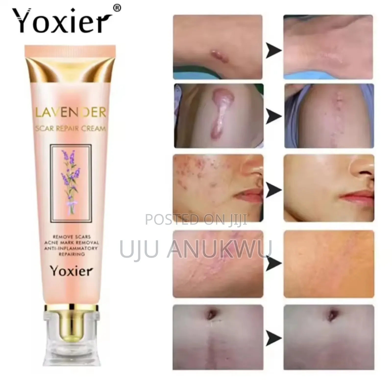Yoxier Lavender Scar Repair Cream