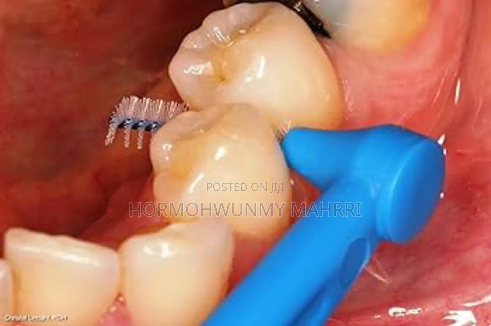Interdental Brush