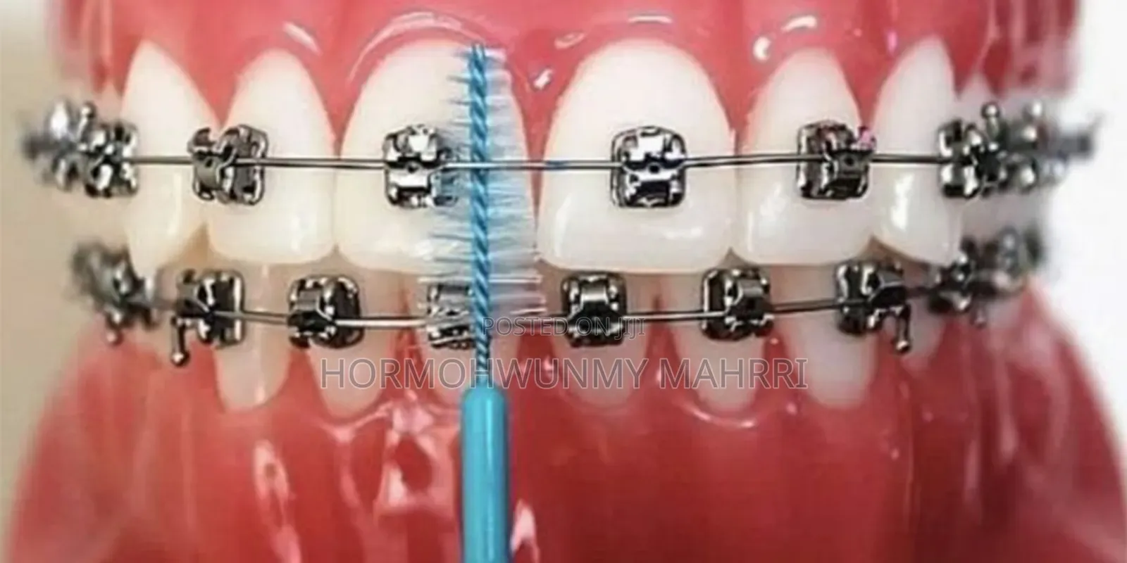 Interdental Brush
