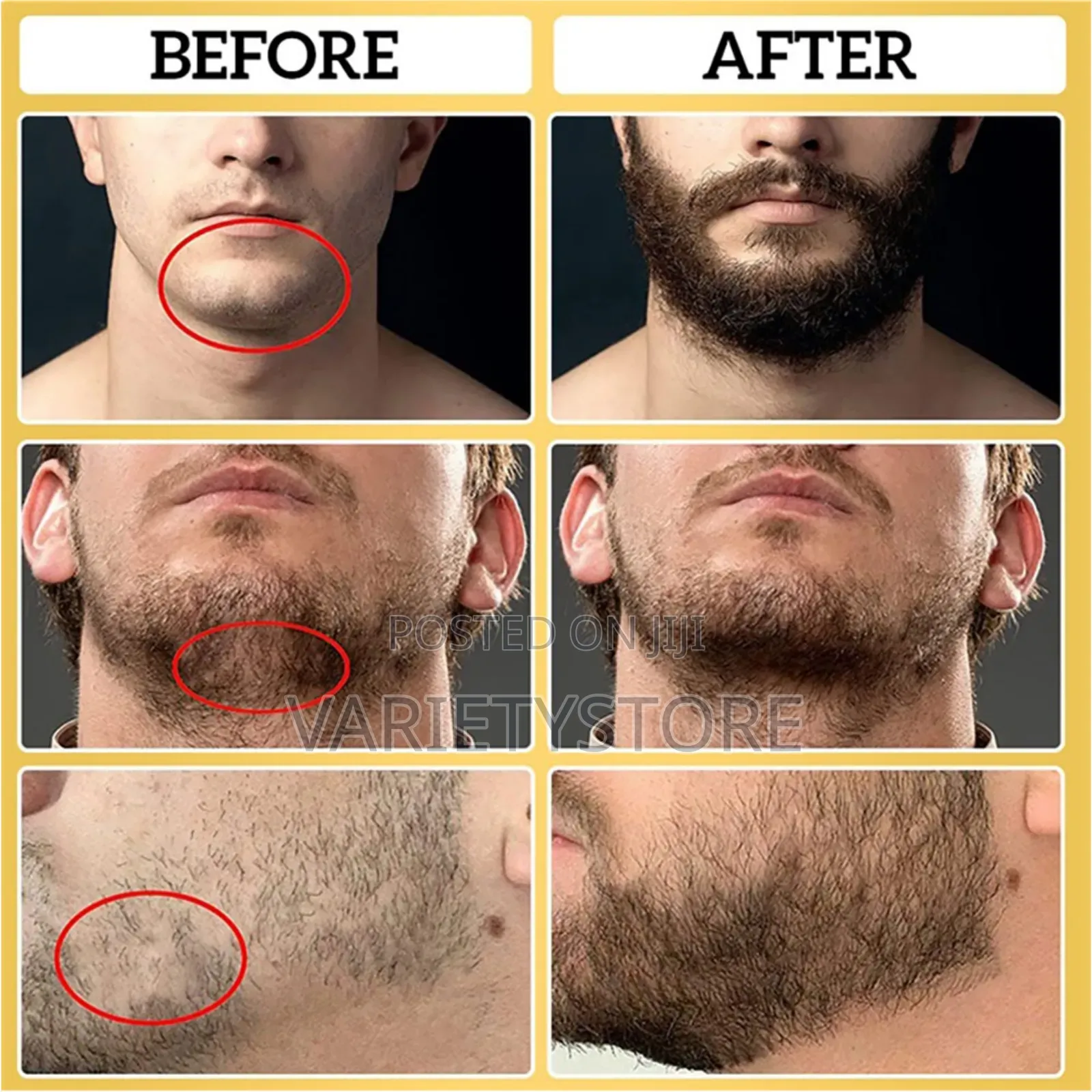 Beard Growth Oil