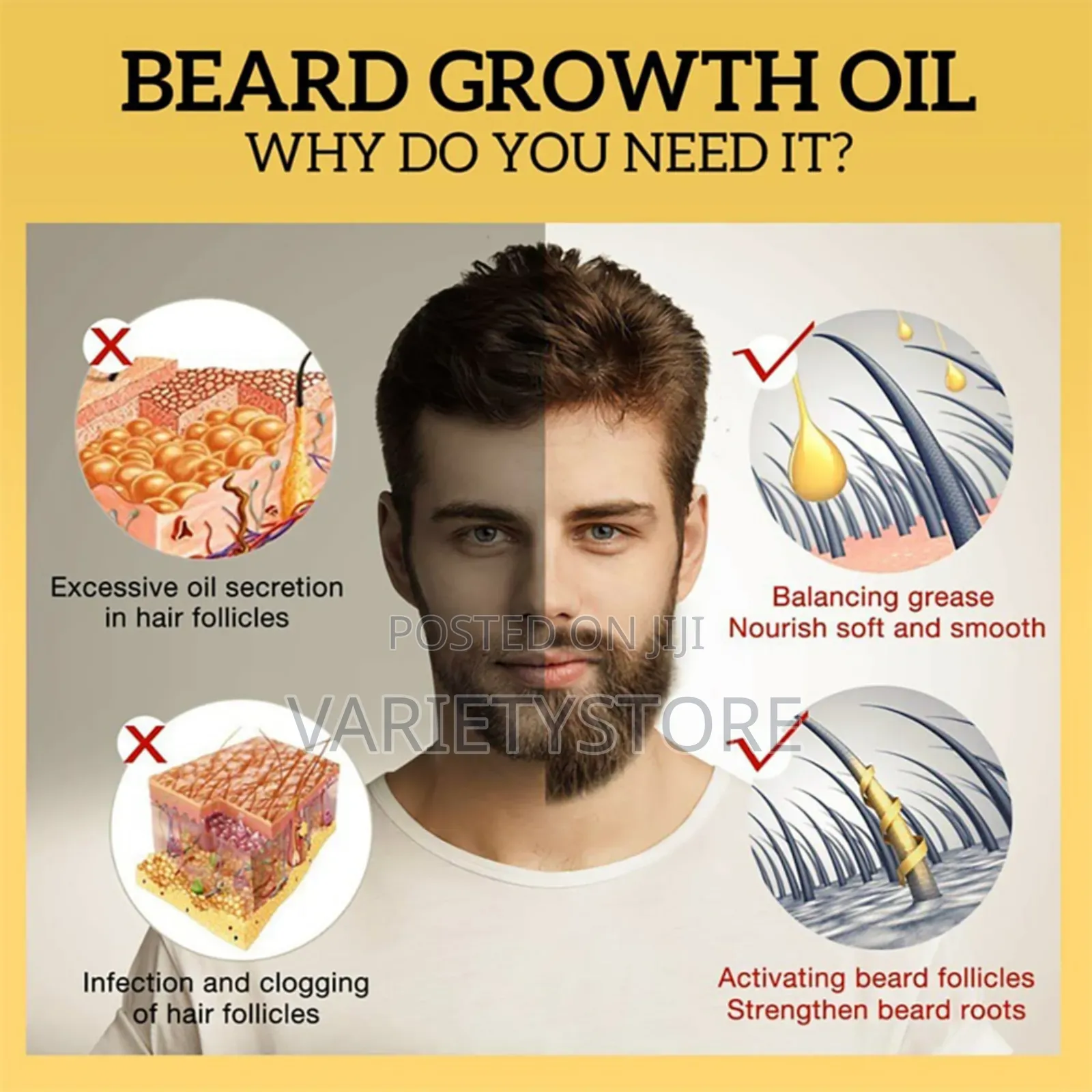 Beard Growth Oil