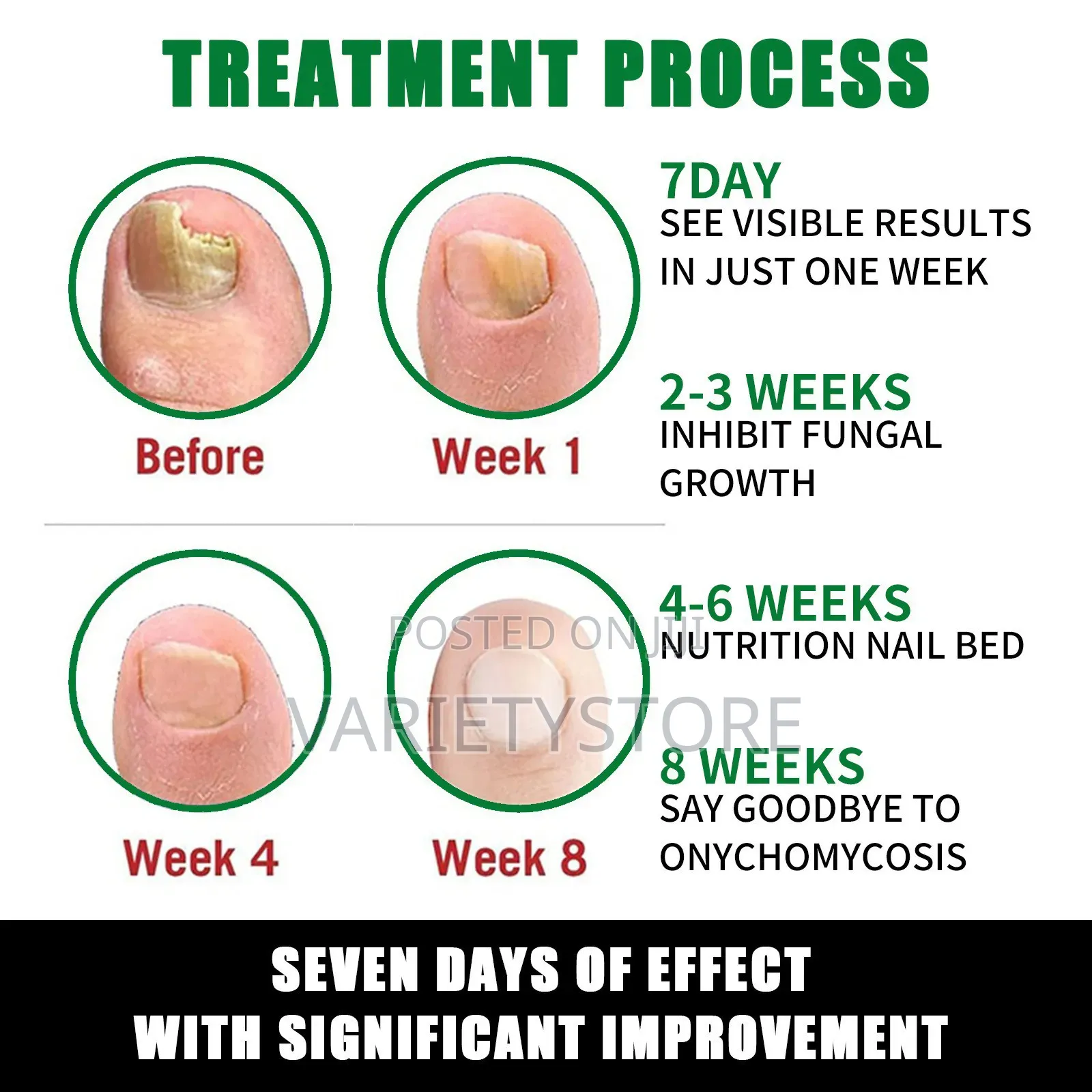 7 Days Fungal Nail Treatment Serum