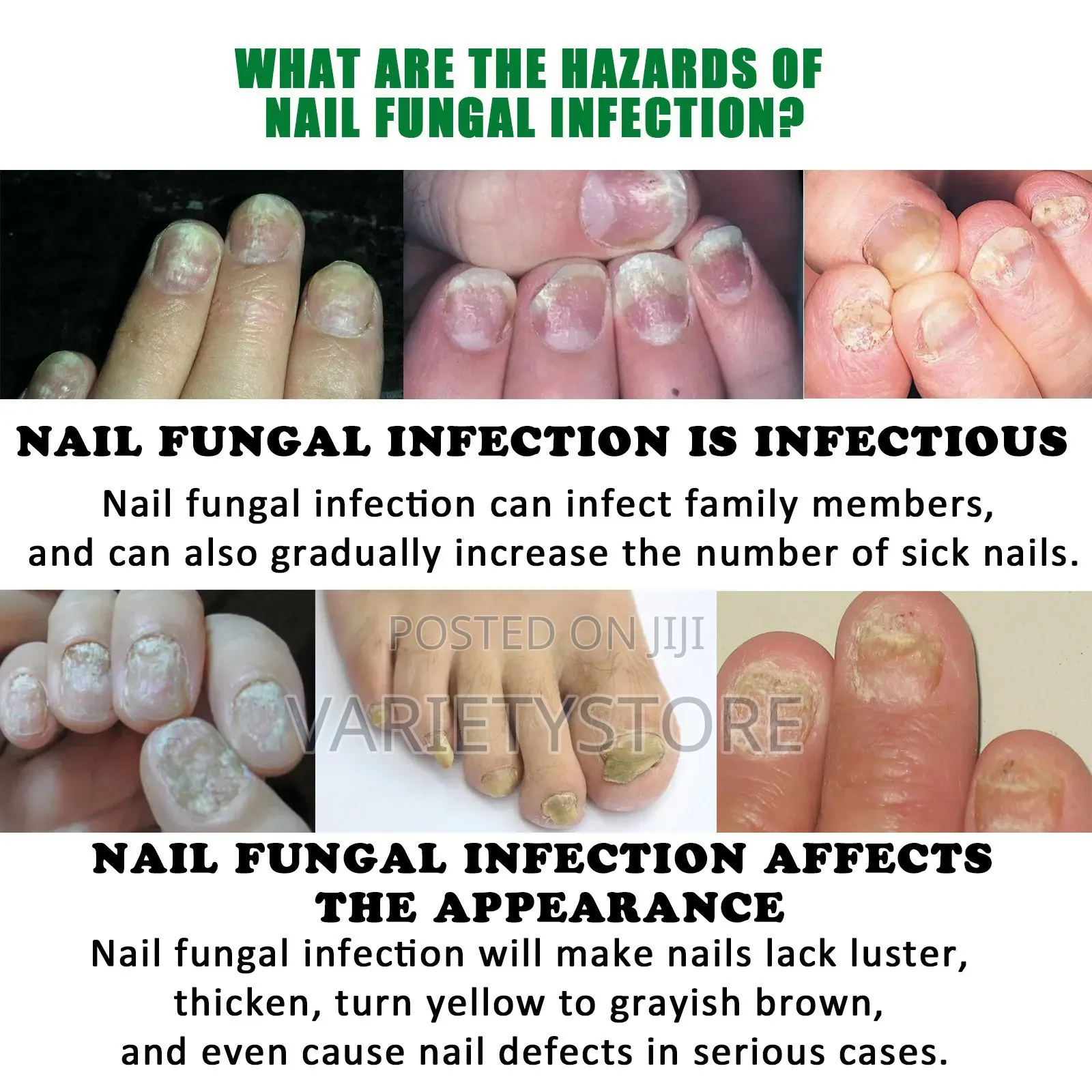 7 Days Fungal Nail Treatment Serum