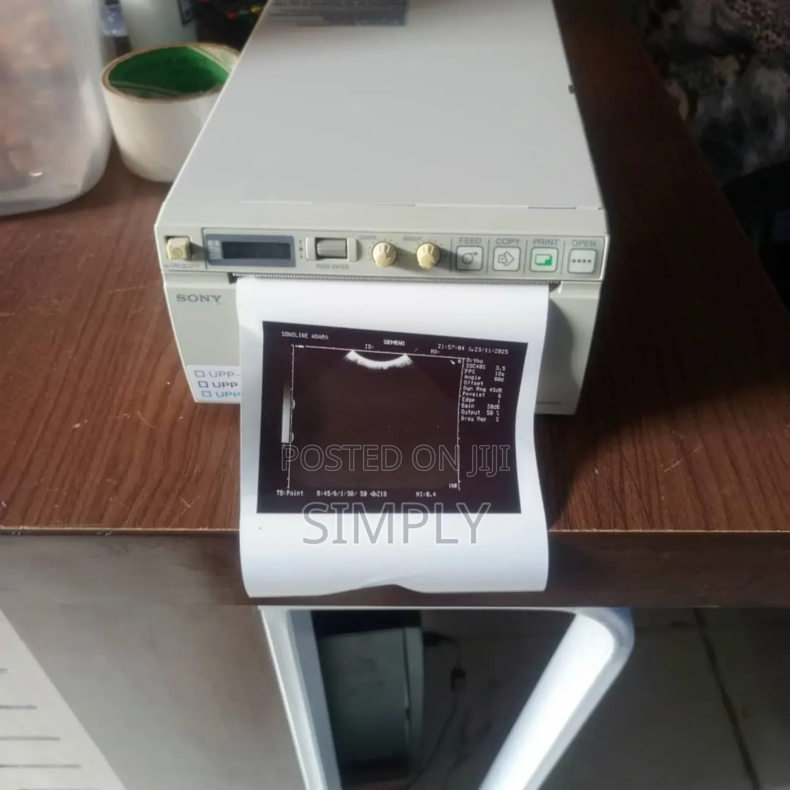 Sony Printer for Scan