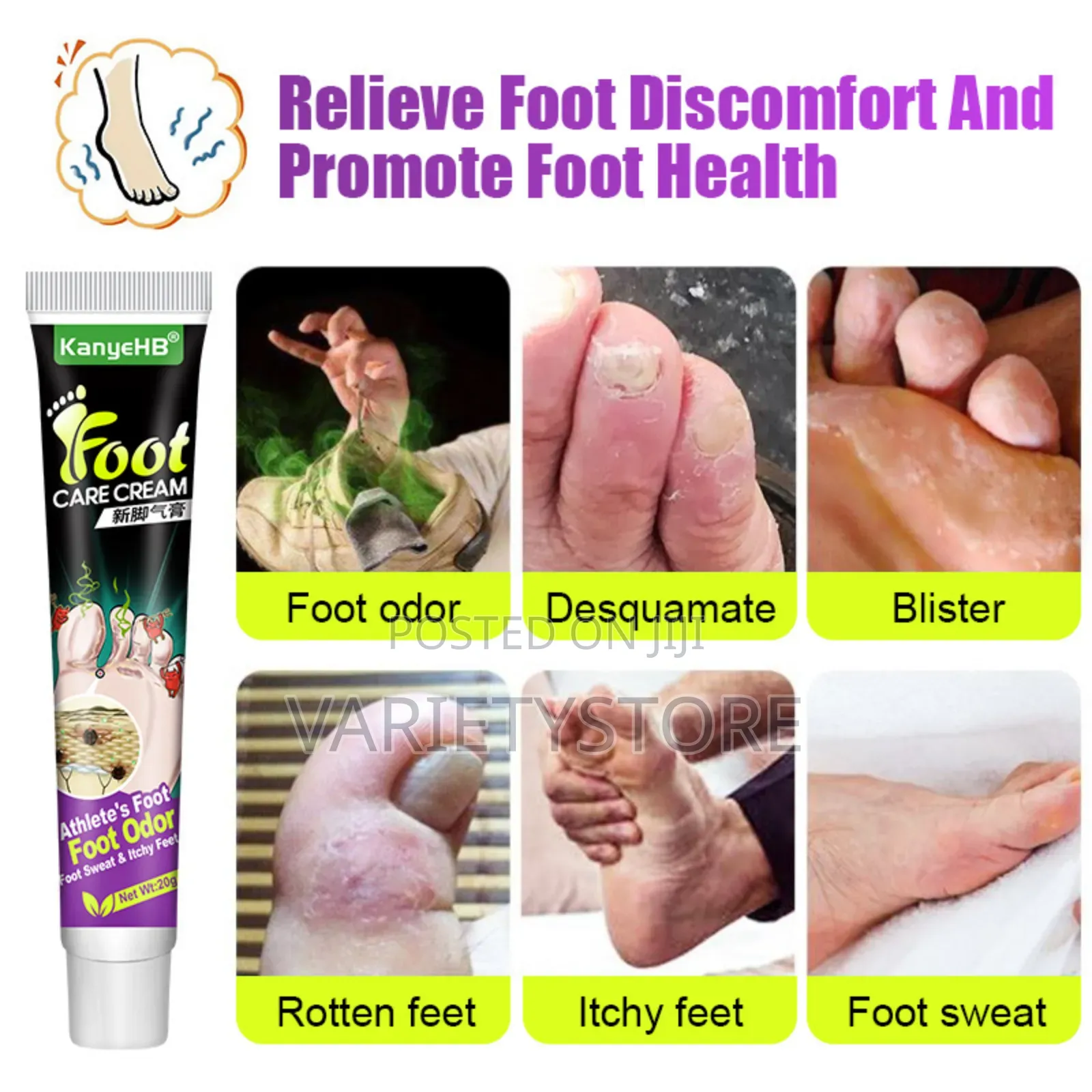 Foot Fungus Removal Cream Remove Beriberi