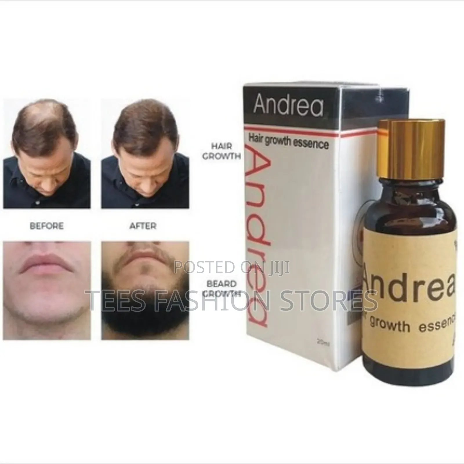 Original Andrea Hair Growth Essence Oil – Fast Hair Edges Regrowth