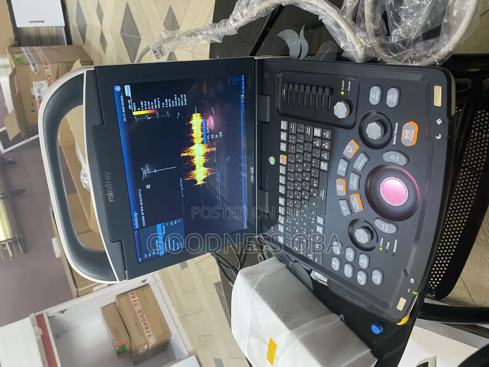 Mindray Dp 10 Ultrasound Machine