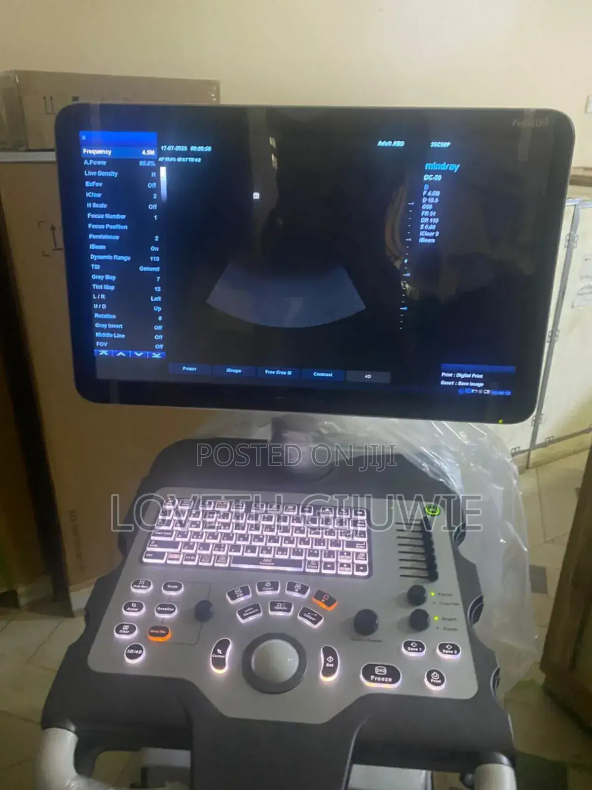 Mindray Dc30 Full Hd Ultrasound Machine