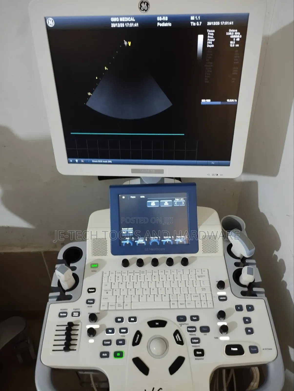 Ge Vivid T8 Ultrasound Machine (Echo)