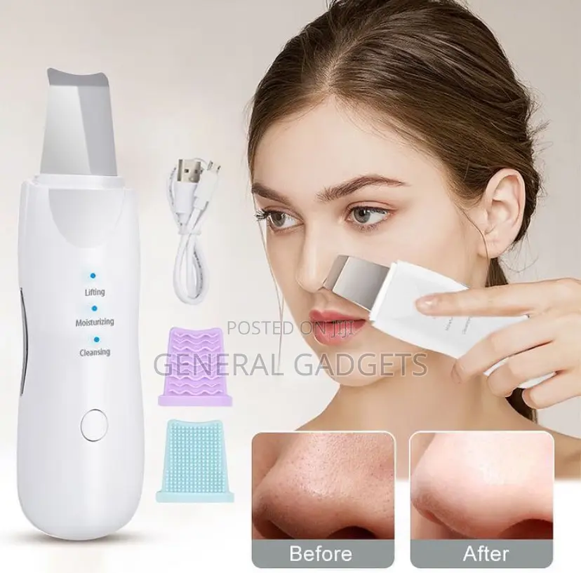 Facial Ultrasonic Scrubber