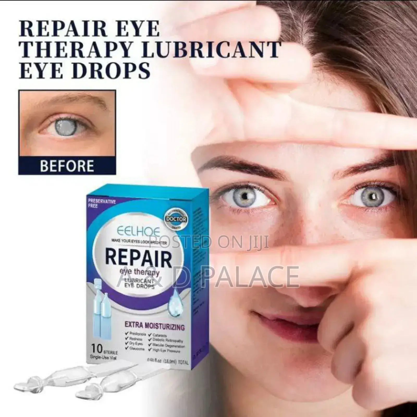 Eelhoe Eye Drops Relieve Tired Eye Irritation