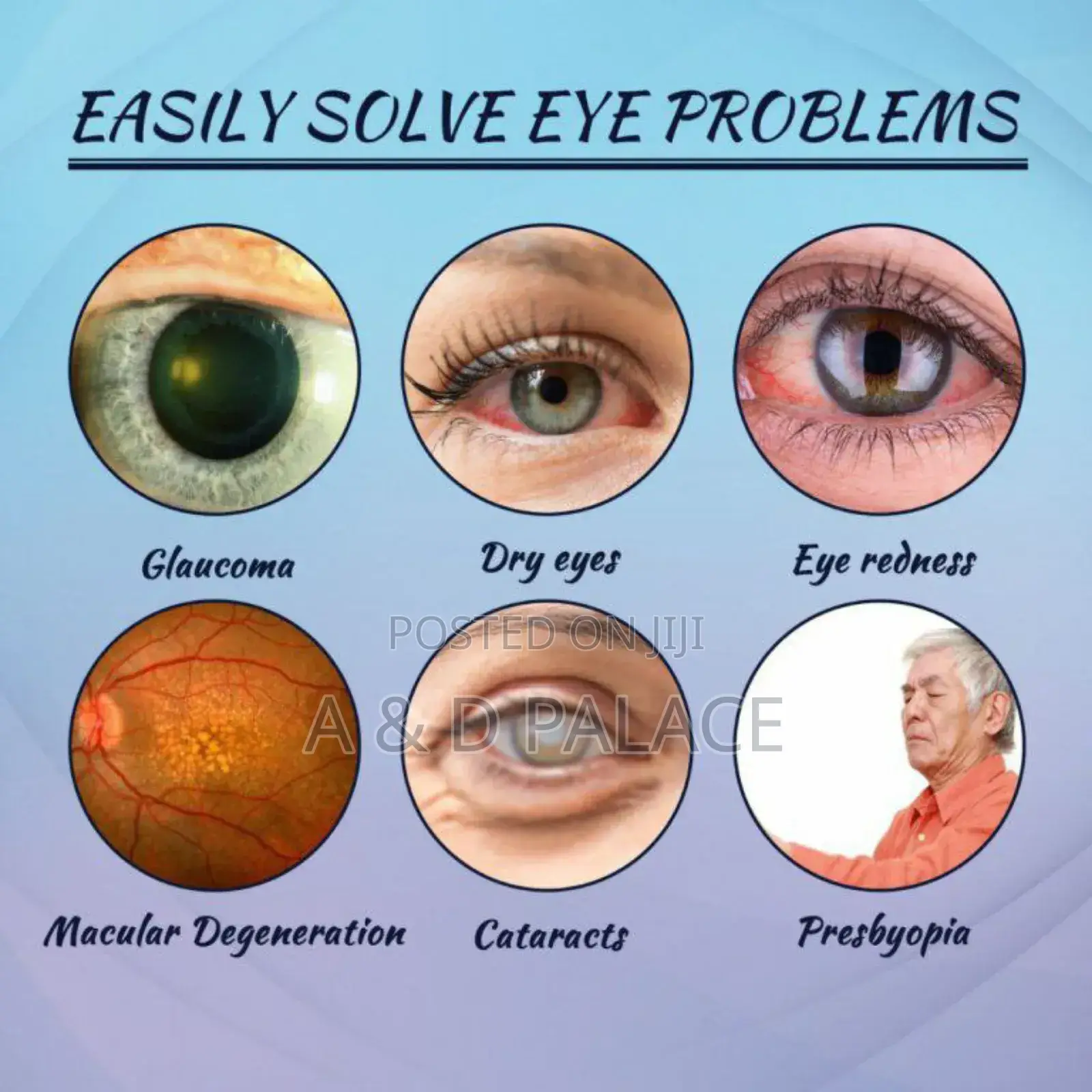 Eelhoe Eye Drops Relieve Tired Eye Irritation