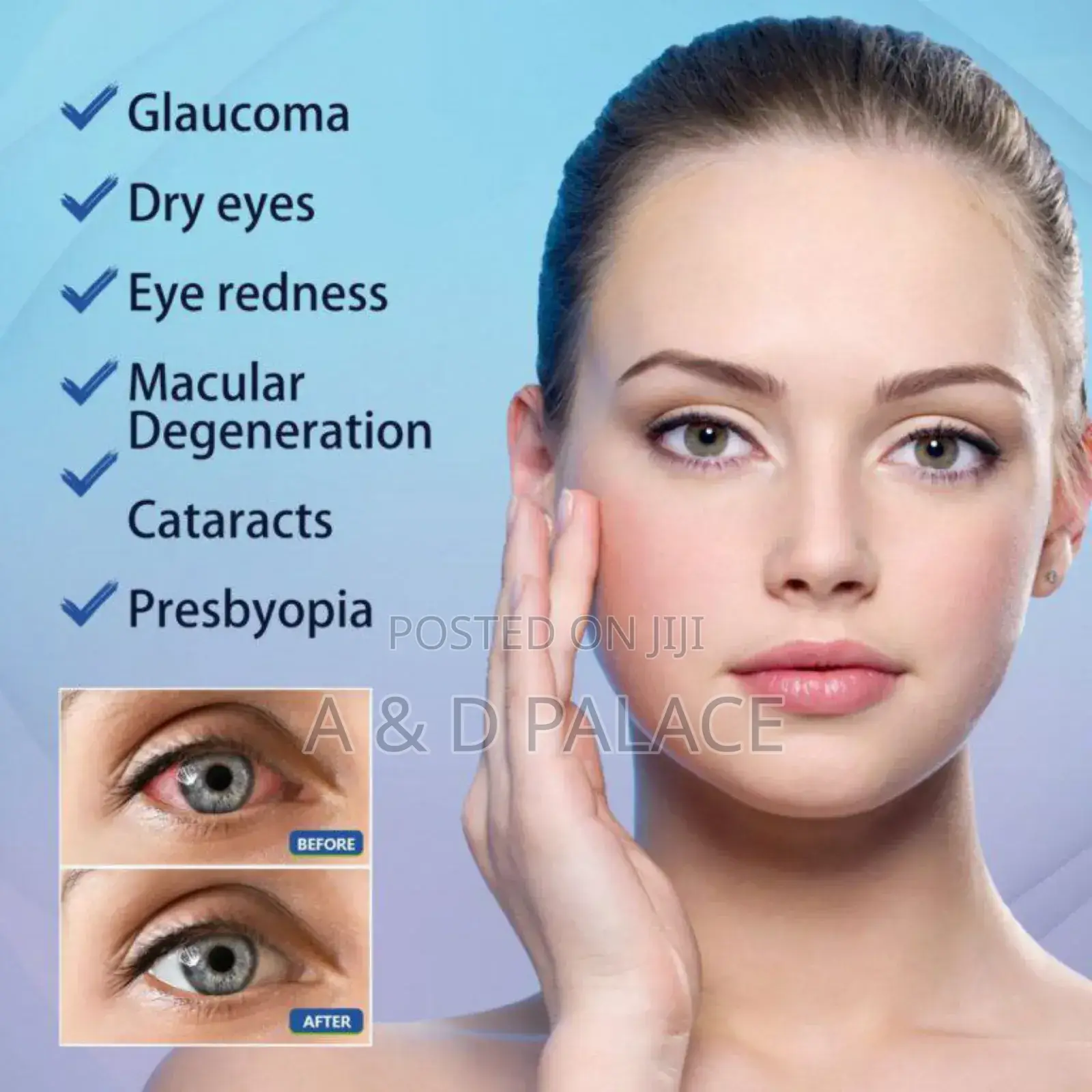 Eelhoe Eye Drops Relieve Tired Eye Irritation