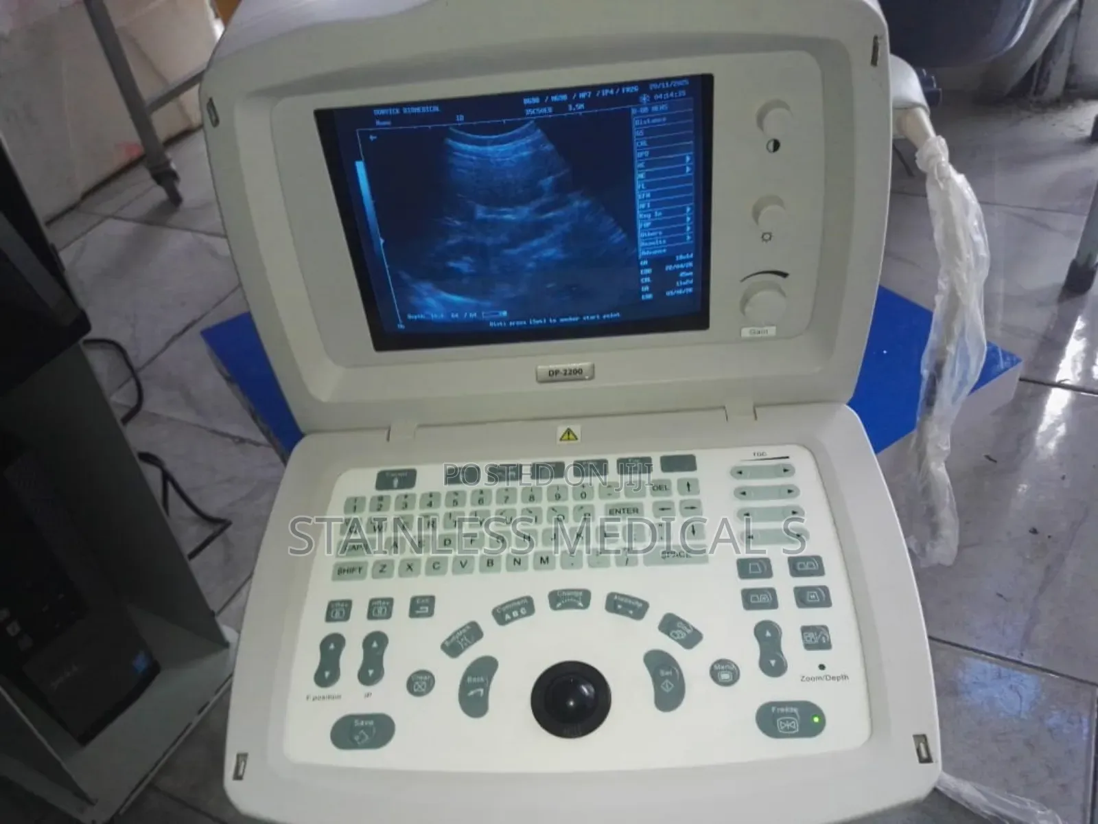 Ultrasound Machine