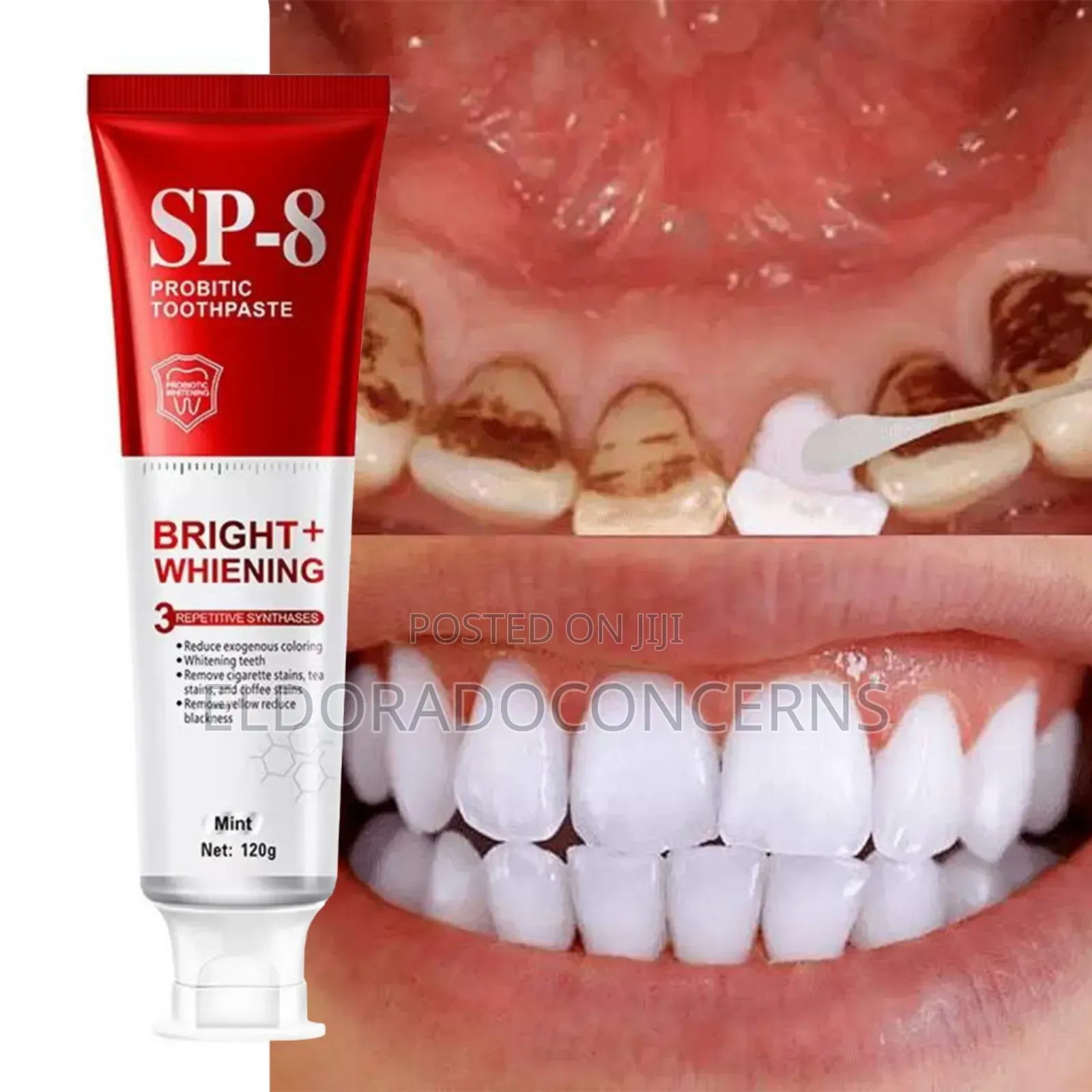 Yayashi Sp 8(Wholesale Price)For a Shinning N White Teeth