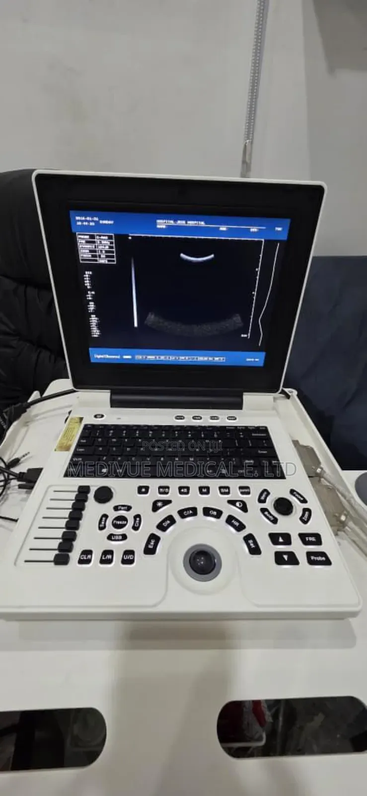 Laptop Ultrasound Scanning Machine