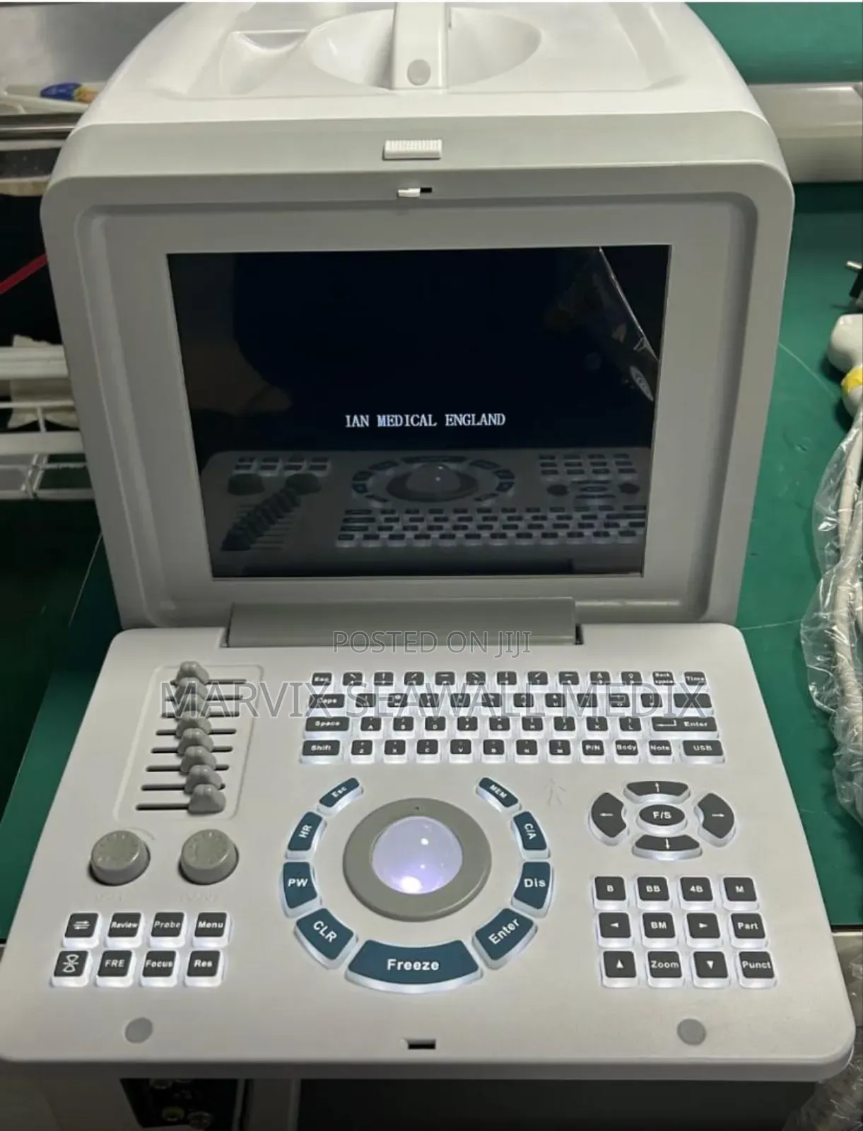Ultrasound Scan Machine