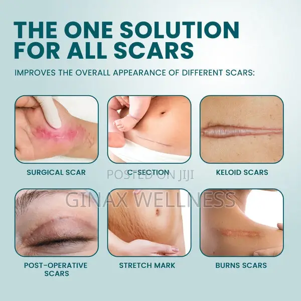 Silicone Scar Cream for Old and New Scars