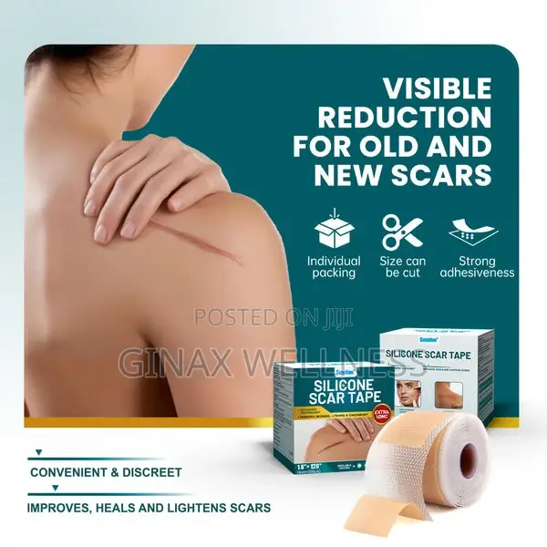 Silicone Scar Tape (Extra Long, 4×300cm, White Color)