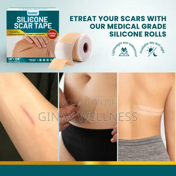 Silicone Scar Tape (Extra Long, 4×300cm, White Color)