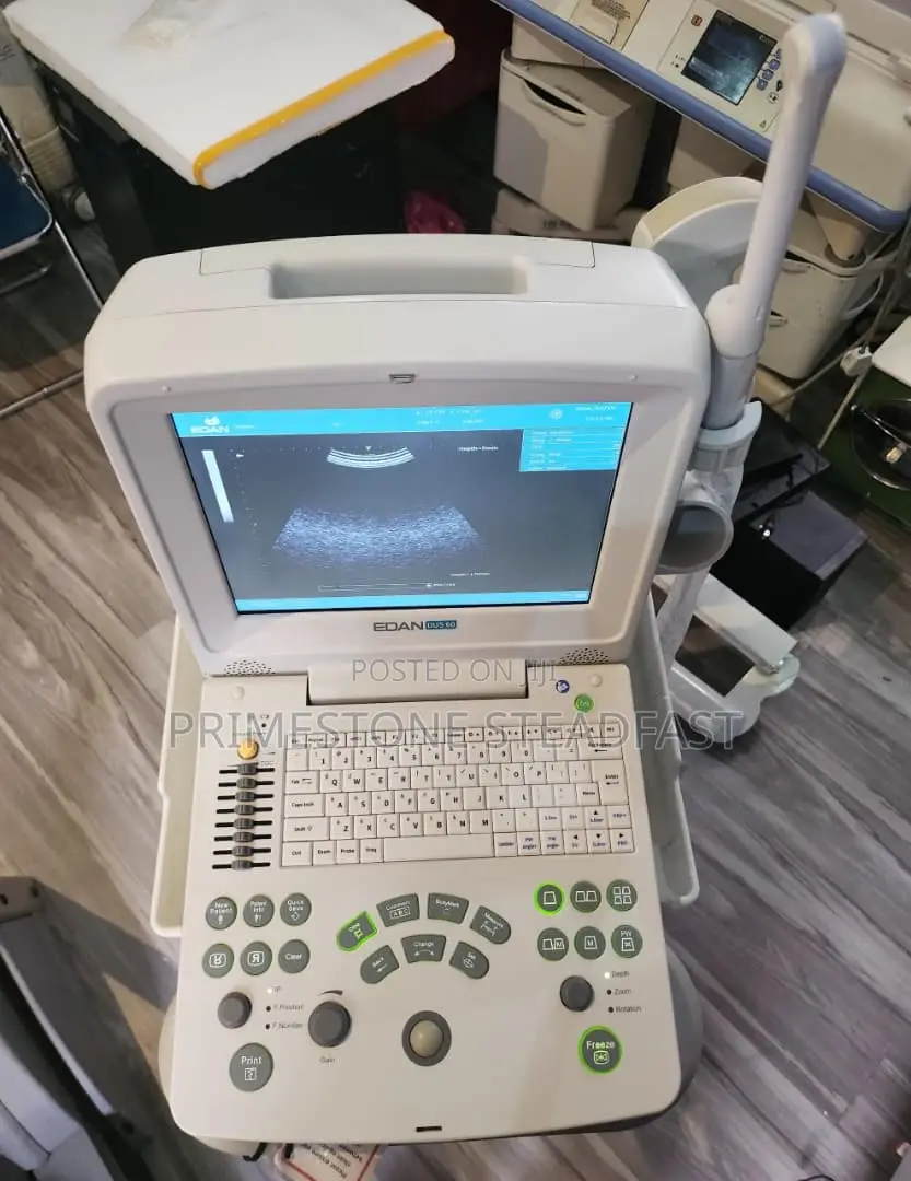 Edan Dus60 Tabletop Ultrasound With Convex Probe