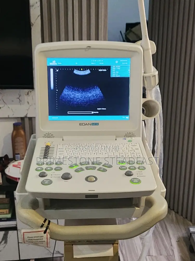 Edan Dus60 Tabletop Ultrasound With Convex Probe