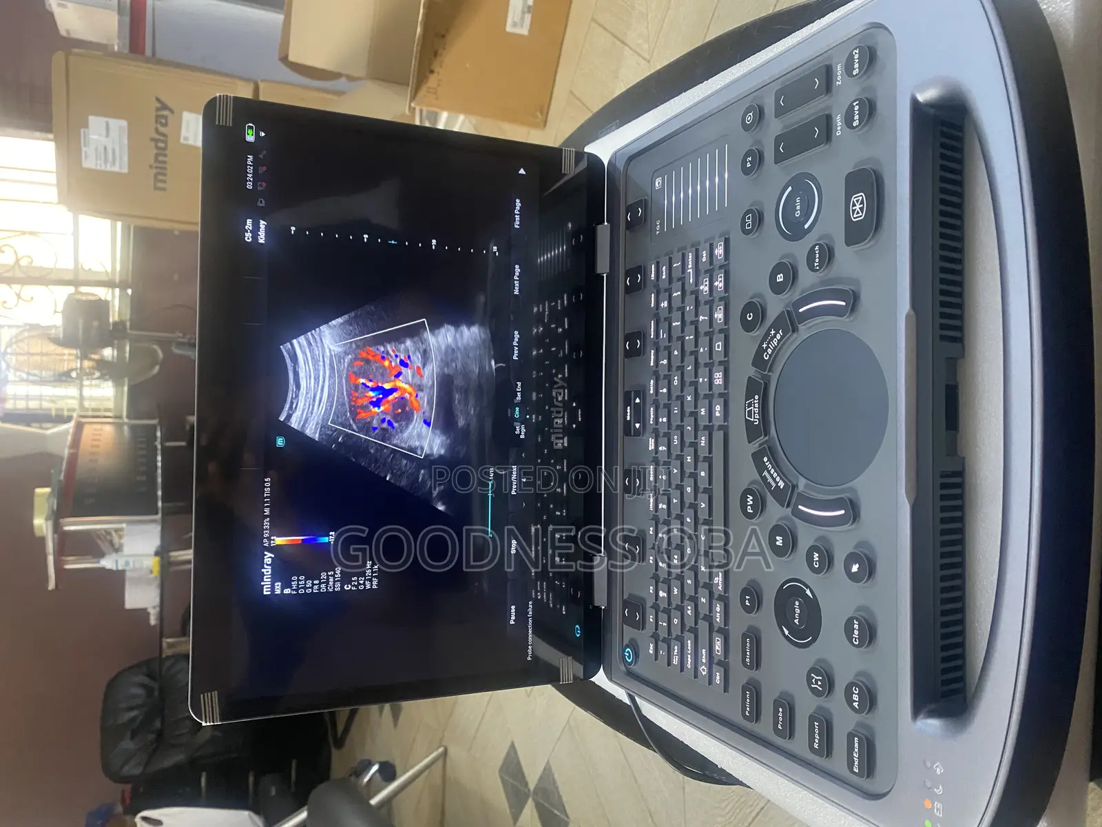 Mindray Mx3 Ultrasound Machine