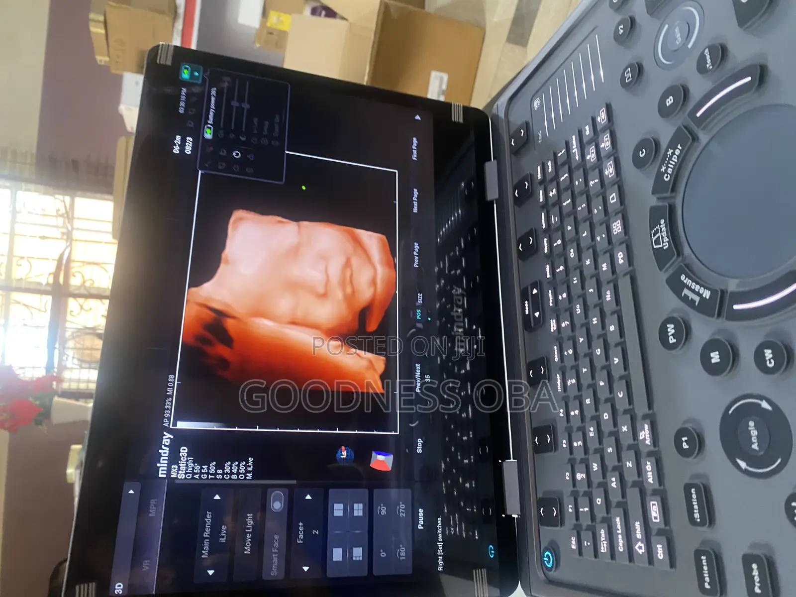 Mindray Mx3 Ultrasound Machine