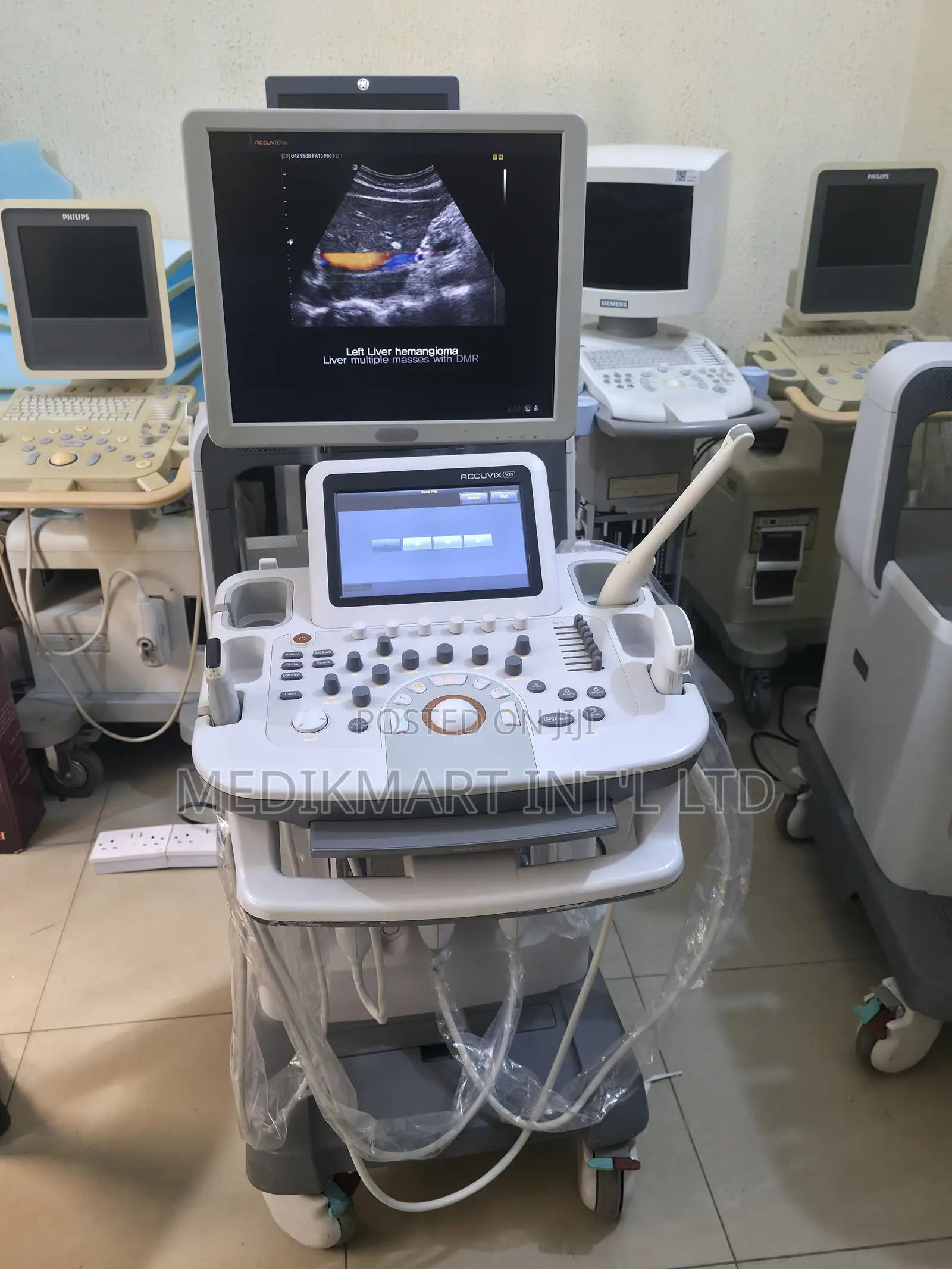 Samsung Accuvix Xg