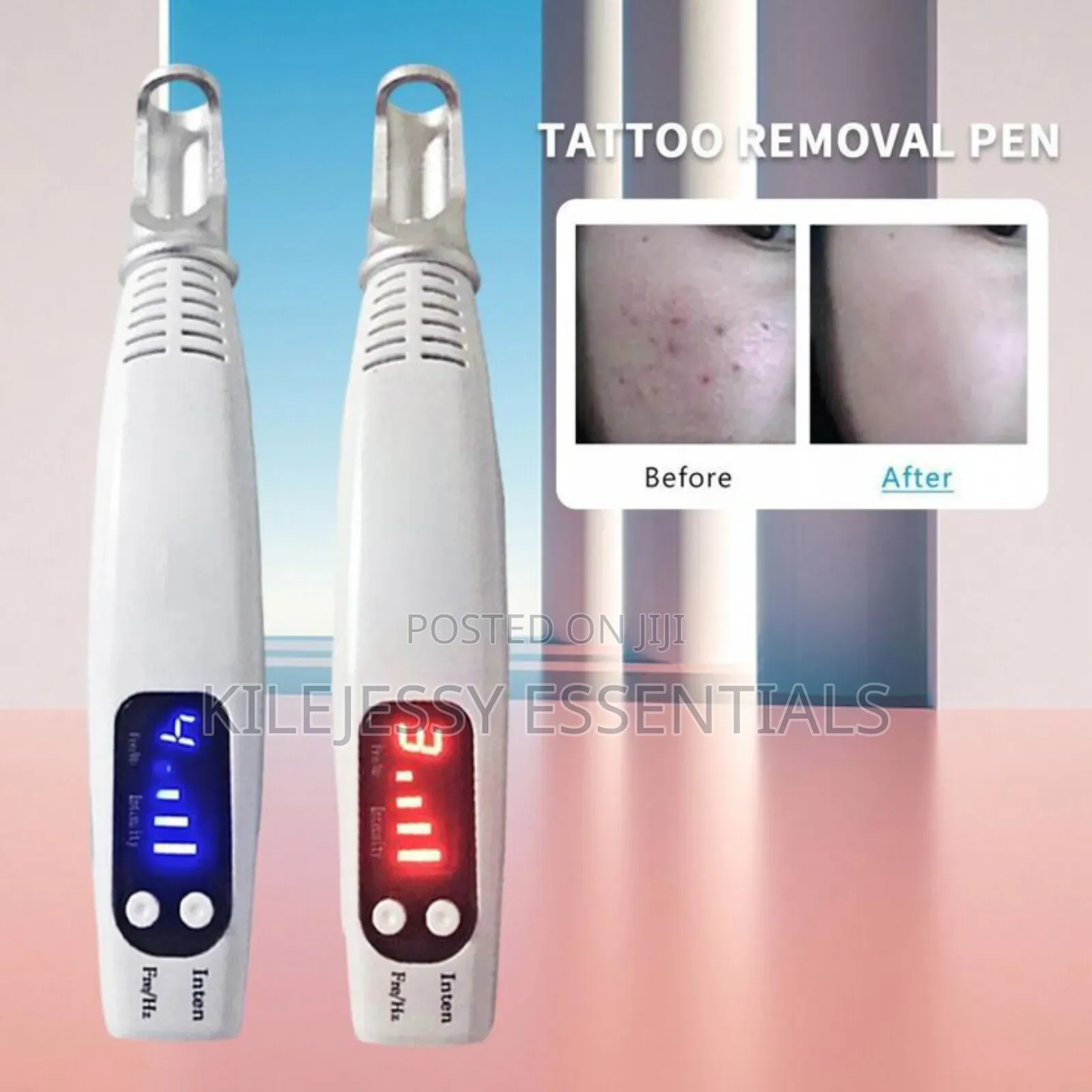 Laser Tattoo Removal Machine