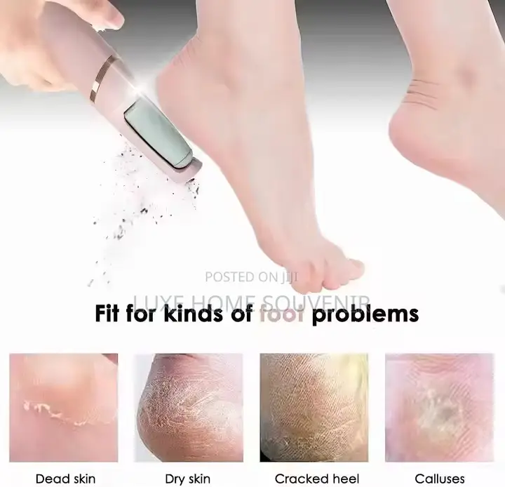 Flawless Rechargeable Callus Remover