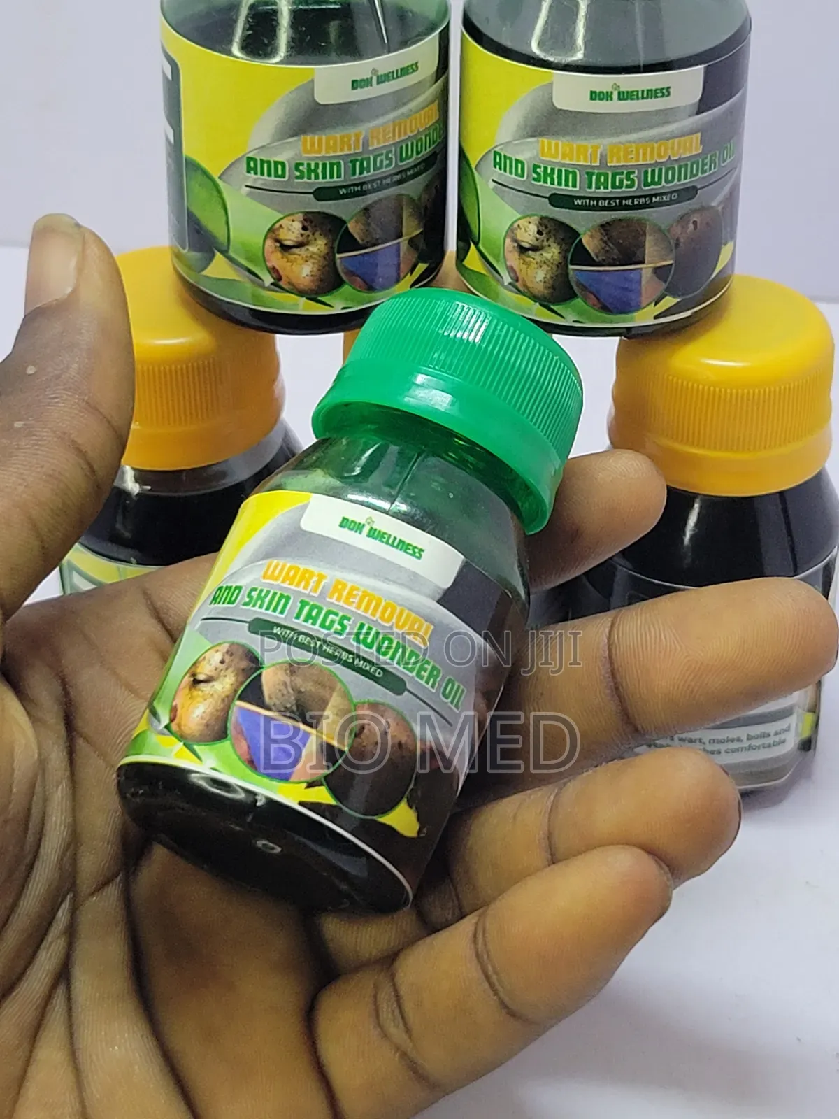 Wart Skin Tag Removal Herbal Oil 25ml– Clear Skin Support