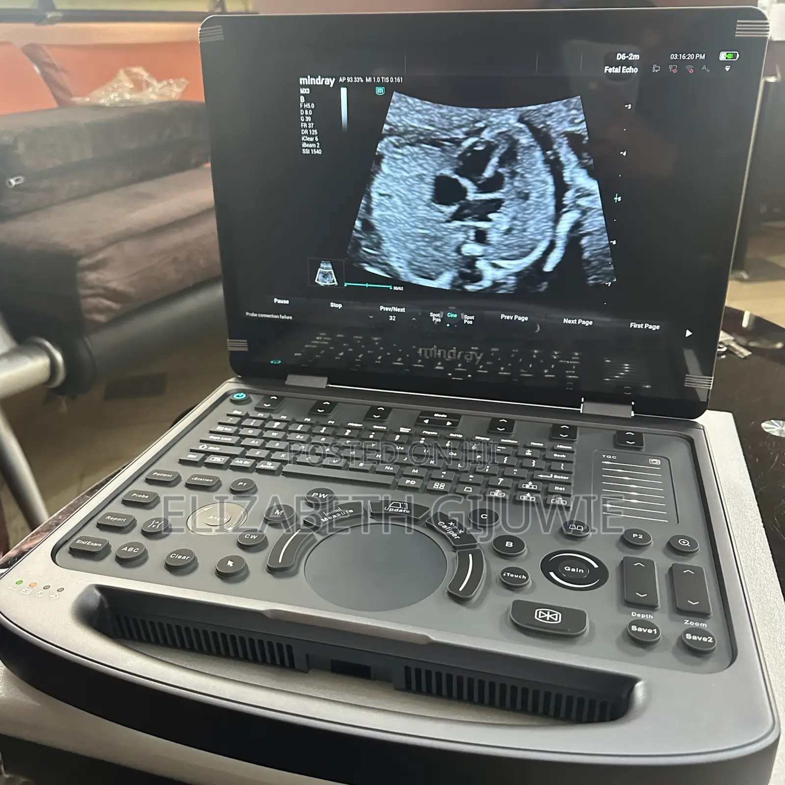 Mindray Mx3 Ultrasound Machine