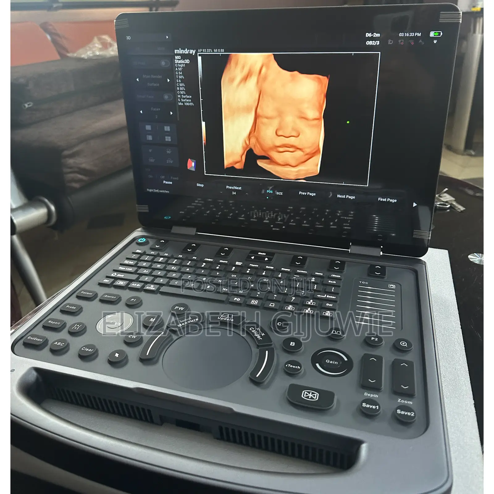 Mindray Mx3 Ultrasound Machine