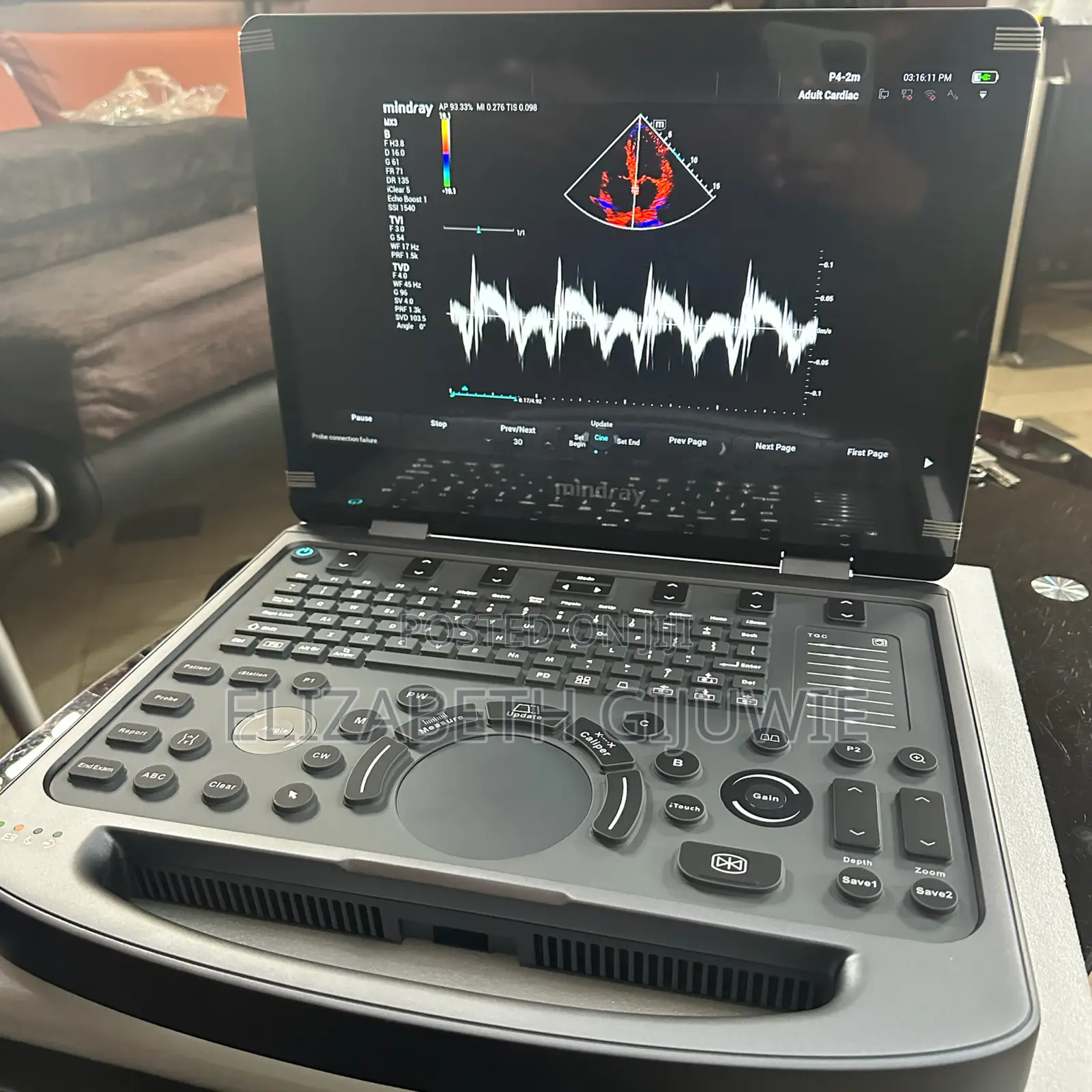 Mindray Mx3 Ultrasound Machine