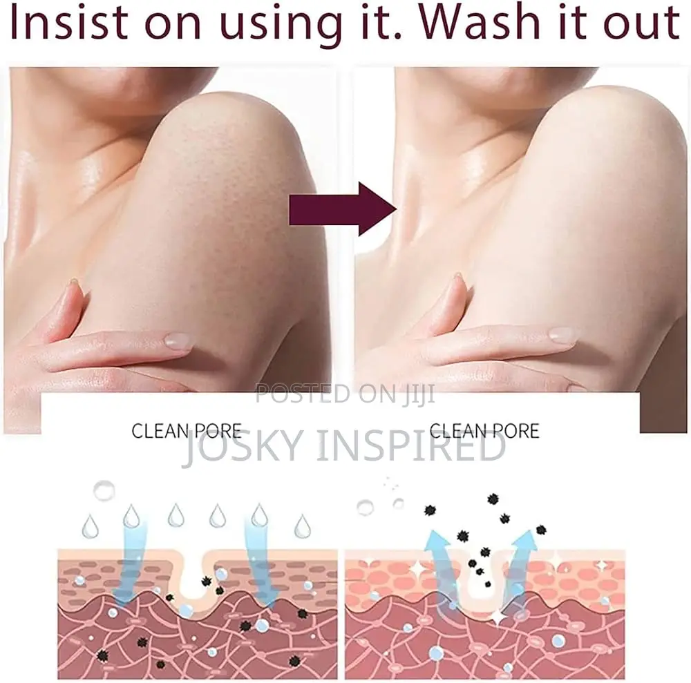 Niacinamide Blackberry Body Scrub, Blackberries Scrubs Exfoliating