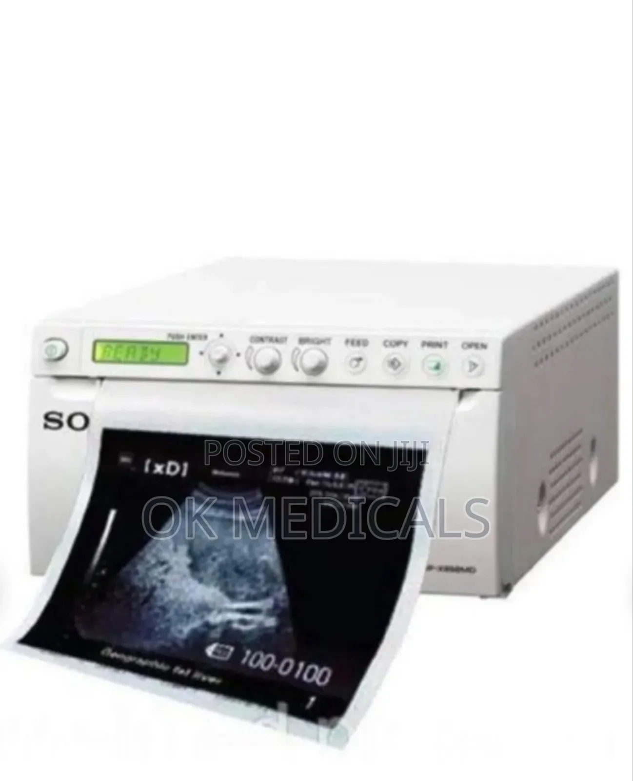 Sony Ultrasound Printer