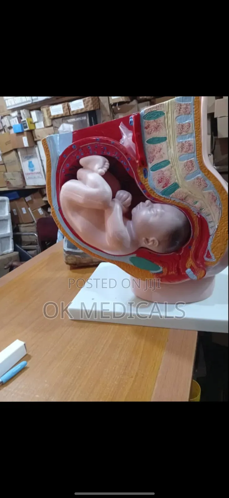 Baby In The Uterus ( Pregnancy Cut Way Suction )