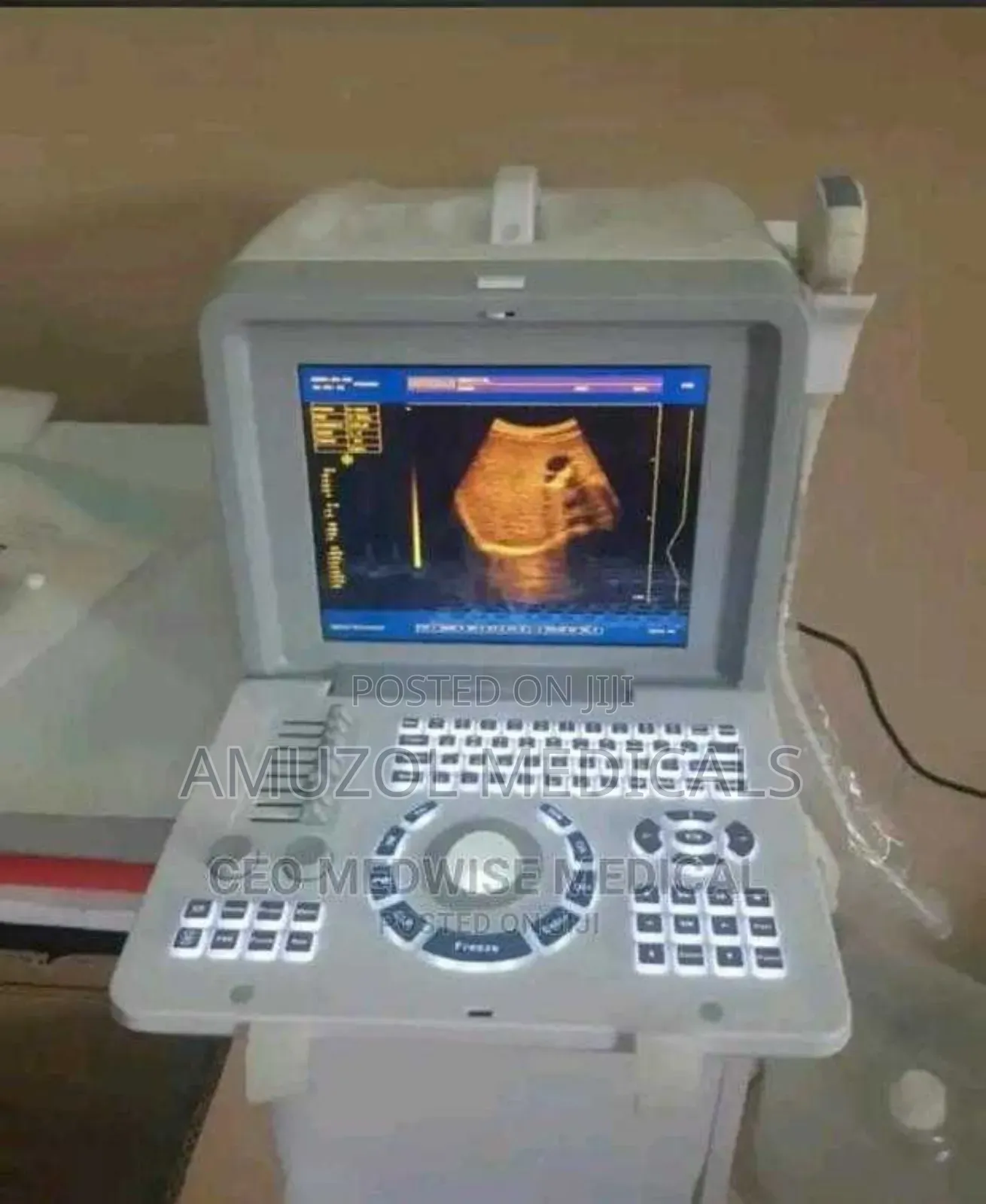 Ultrasound Scanning Machine