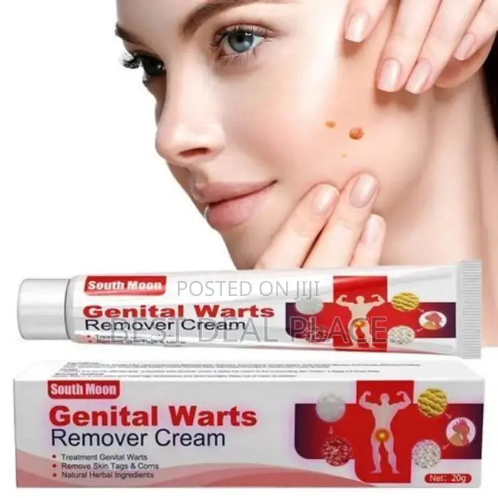 South Moon Genital Warts Removal Cream
