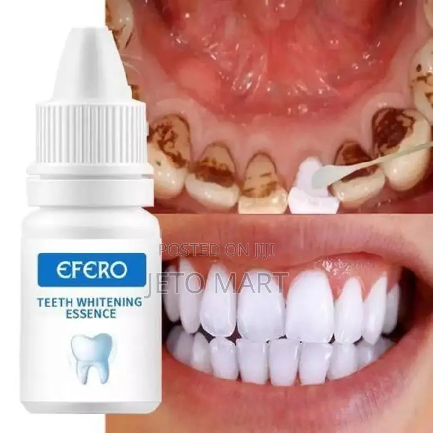 Efero Teeth Whiten Kit – Whitening Teeth, Bright Smiles