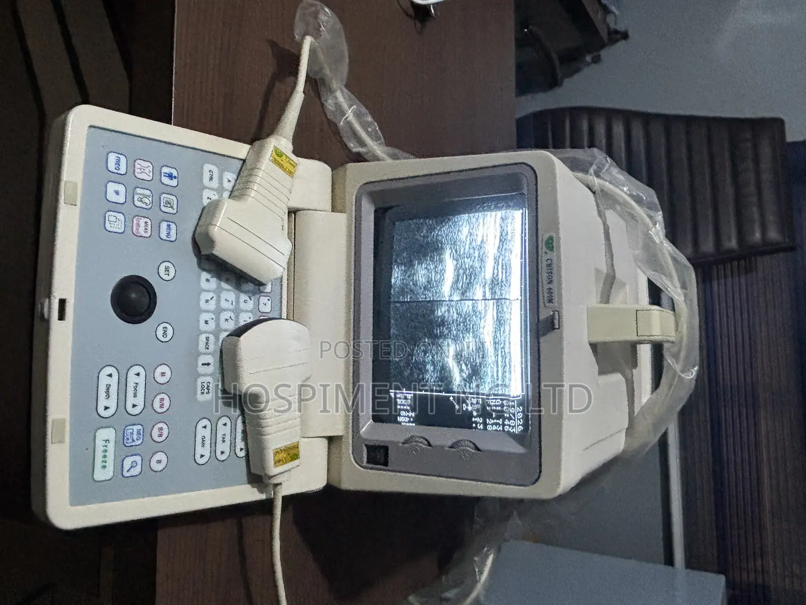 Chison 600m Table Top Ultrasound Machine