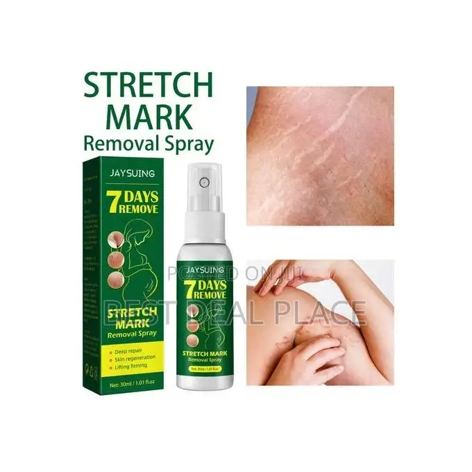 Jaysuing 7 Days Super Strong Stretch Mark Removal Spray