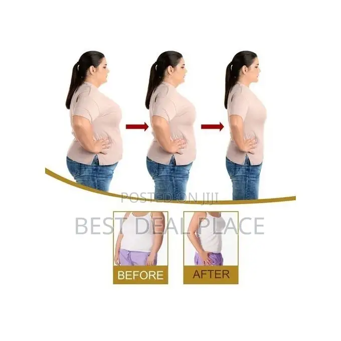 Eelhoe Effective Ginger Essential Oils Losing Weight Slimming 30ml
