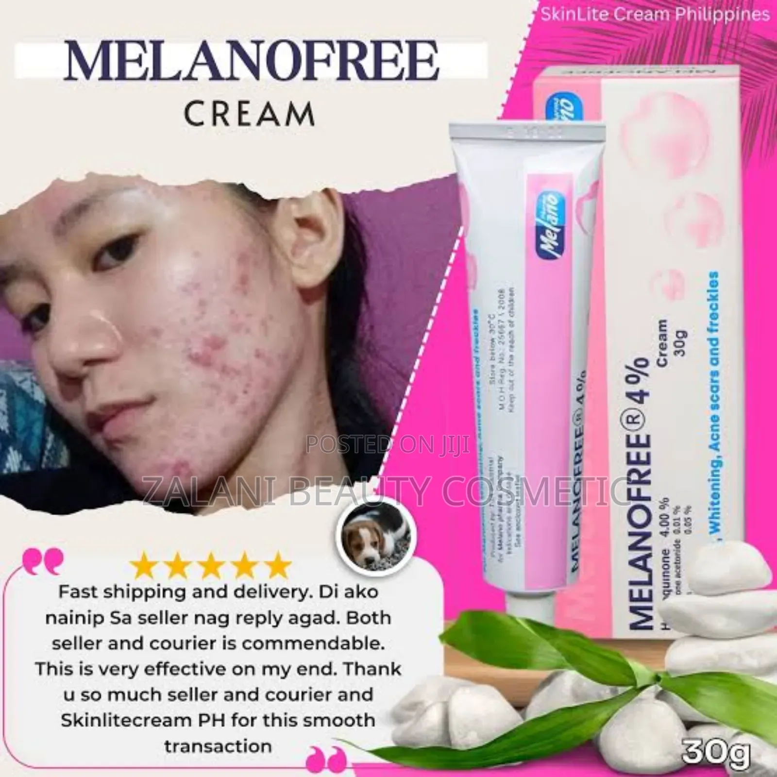 Melanofree 4% Cream, Which Is a Topical Treatment Formulated