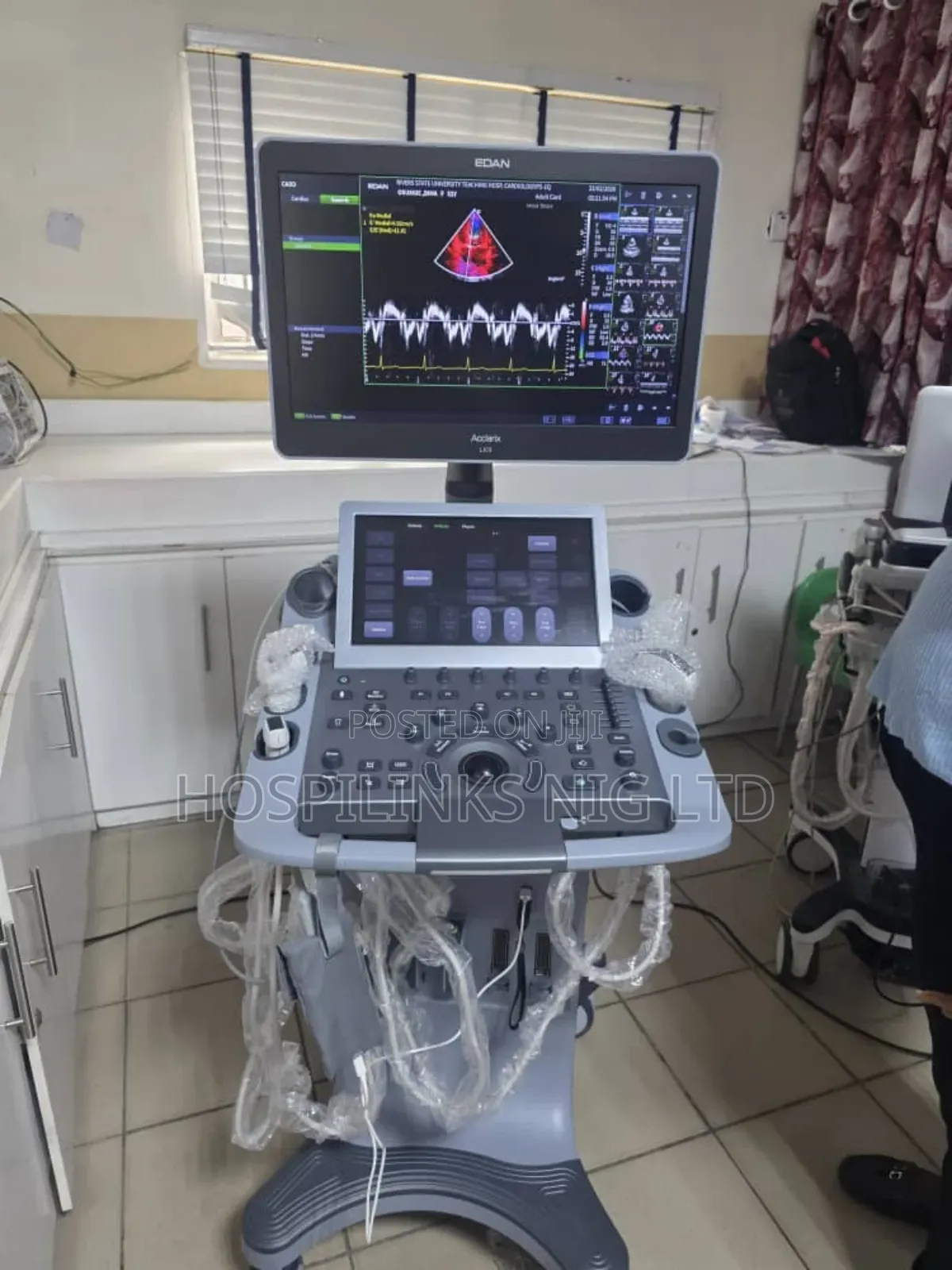 Ultrasound Machine 4d Colored